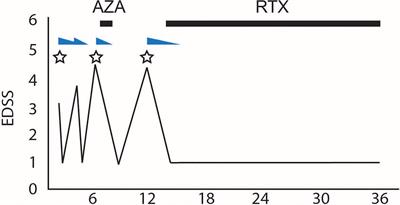 Case Report: Myelin Oligodendrocyte Glycoprotein Antibody-Associated Disorder Masquerading as Multiple Sclerosis: An Under-Recognized Entity?